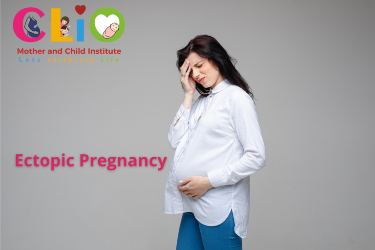 Ectopic Pregnancy